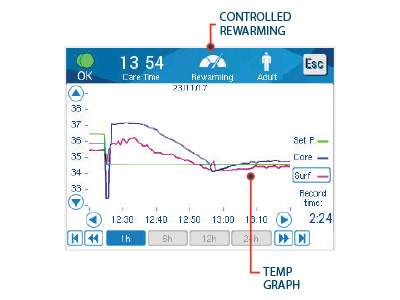 Controlled Rewarming